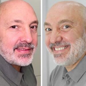 Pelo a Pelo Masculino